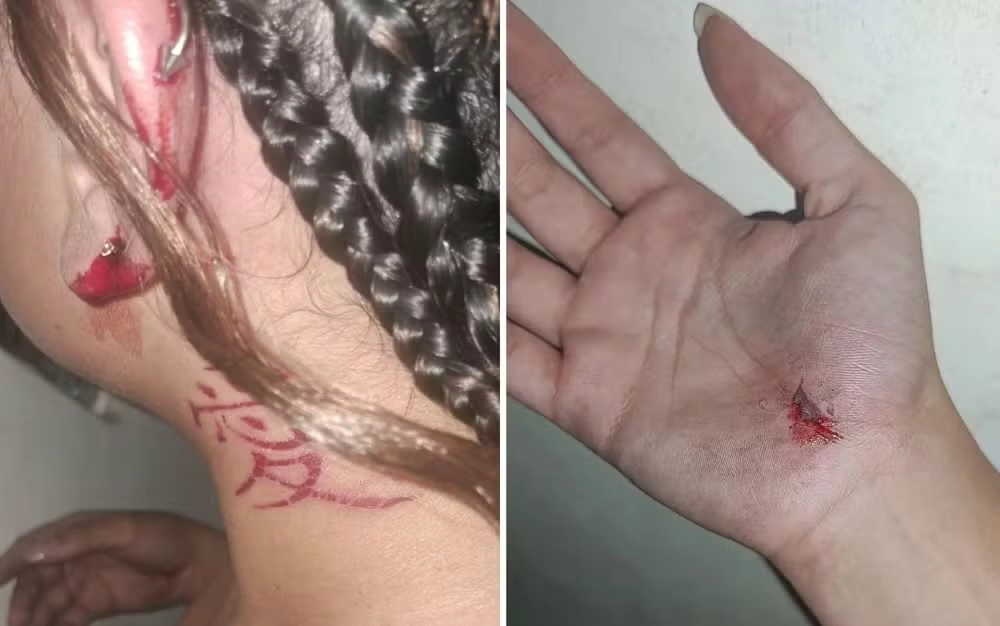 ESTUDANTE DE 19 ANOS É PERSEGUIDA E AGREDIDA COM SOCO NO ROSTO EM VITÓRIA DA CONQUISTA