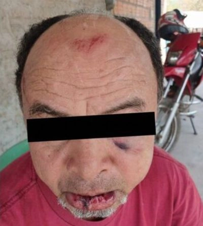Conta de R$ 60 termina em pancadaria e envolve policial militar em São Félix do Araguaia (MT)