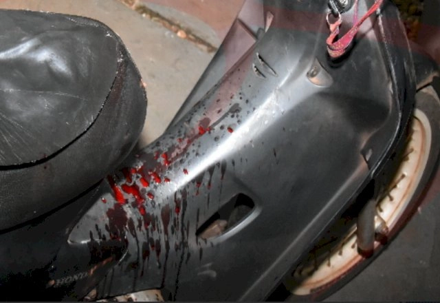Baleado no pescoço, motociclista pede ajuda em hospital e é intubado
