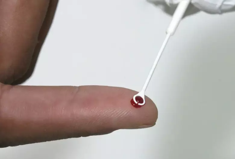 Fiji declara emergência nacional por HIV com 1 caso a cada 60 pessoas