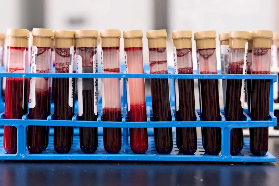 Exame de sangue que busca detectar mais de 50 tipos de câncer chega ao Brasil