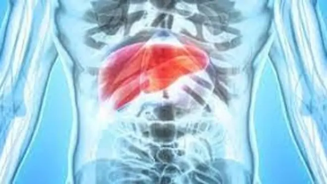 Gordura no fígado pode evoluir para cirrose e câncer; veja como prevenir