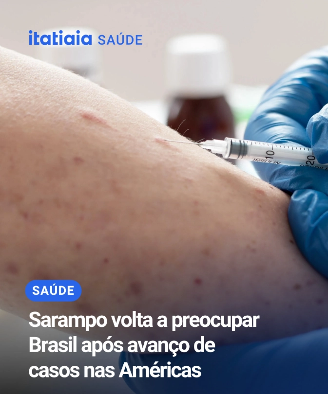 Sarampo volta a preocupar o Brasil após avanço de casos nas américas