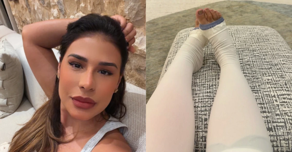 Simone Mendes revela cirurgia nas coxas após perder 30 kg: ‘Era o meu sonho’